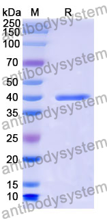 Recombinant Mouse VSTM5 Protein, N-GST & C-His