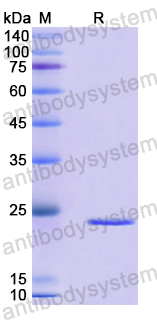 Recombinant Mouse RELT Protein, N-His-SUMO