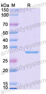 Recombinant Mouse P2RY12 Protein, N-GST & C-His