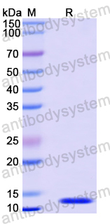Recombinant Mouse FRZB Protein, N-His