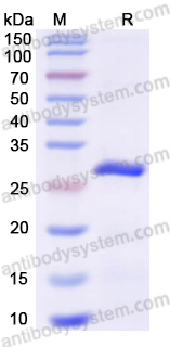 Recombinant Mouse a1ACT/Serpina3n Protein, N-His