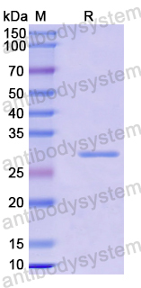 Recombinant Mouse WNT5B Protein, N-His