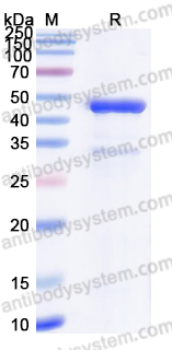 Recombinant Mouse IL4I1 Protein, N-His