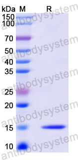 Recombinant Mouse ASAH2 Protein, N-His