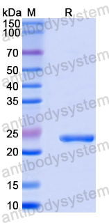 Recombinant Mouse TREML4 Protein, N-His-SUMO