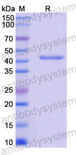 Recombinant Mouse Reg3b Protein, N-GST & C-His