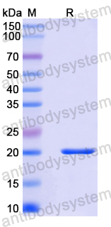 Recombinant Mouse AMIGO3 Protein, N-His