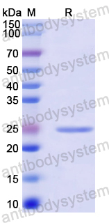 Recombinant Mouse APCDD1 Protein, N-His