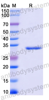 Recombinant Mouse ST6GALNAC2/SIAT7-B Protein, N-His