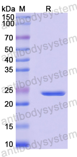 Recombinant Mouse VSIG1 Protein, N-His
