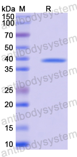 Recombinant Mouse Timd2/G9D3 protein Protein, N-GST & C-His