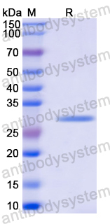 Recombinant Mouse NTNG2/Netrin-G2 Protein, N-His