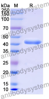 Recombinant Mouse VSTM2L Protein, N-GST & C-His
