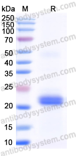 Recombinant Mouse ZNRF3 Protein, N-His