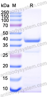 Recombinant Mouse NINJ1 Protein, N-GST & C-His