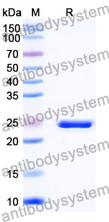 Recombinant Mouse TARM1 Protein, N-His