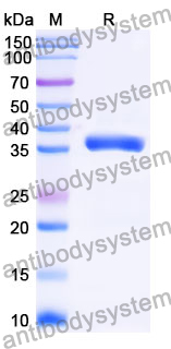 Recombinant Mouse Osteomodulin/OMD Protein, N-His