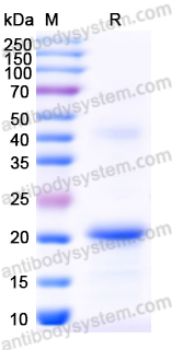 Recombinant Mouse EPHA6 Protein, N-His