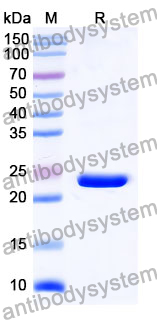Recombinant Mouse FSTL5 Protein, N-His