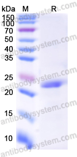 Recombinant Mouse ROBO3 Protein, N-His