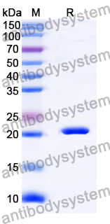 Recombinant Mouse Ctf2 Protein, N-His