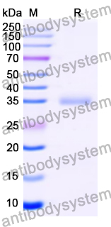 Recombinant Mouse Pirb/Lilrb3 Protein, N-His