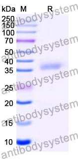 Recombinant Mouse EDA2R Protein, N-GST & C-His