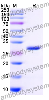 Recombinant Mouse TINAGL1 Protein, N-His