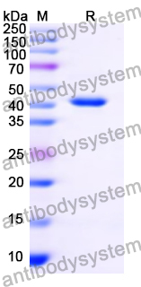 Recombinant Mouse TNFRSF19 Protein, N-GST & C-His