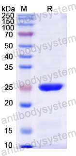 Recombinant Mouse TMEM87A Protein, N-His