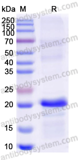 Recombinant Rat IGF2 Protein, N-His