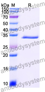 Recombinant Rat MT-1 Protein, N-GST & C-His