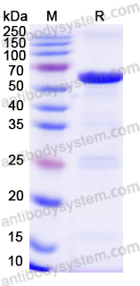 Recombinant Rat P4HA1 Protein, N-His