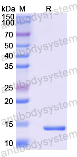 Recombinant Rat CTGF/CCN2 Protein, N-His