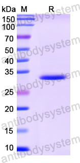 Recombinant Rat SCNN1A/SCNN1 Protein, N-His