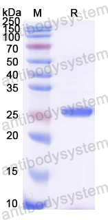 Recombinant Rat C1QBP Protein, N-His
