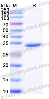 Recombinant Rat METRNL/Subfatin Protein, N-His