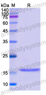 Recombinant Rabbit IL2 Protein, C-His