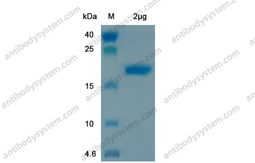 Recombinant SARS-CoV-2 S Protein, N-His