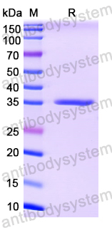 Recombinant SARS-CoV-2 NTD Protein, N-His