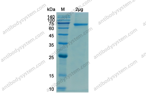 Recombinant SARS-CoV-2 S1 Protein, N-His