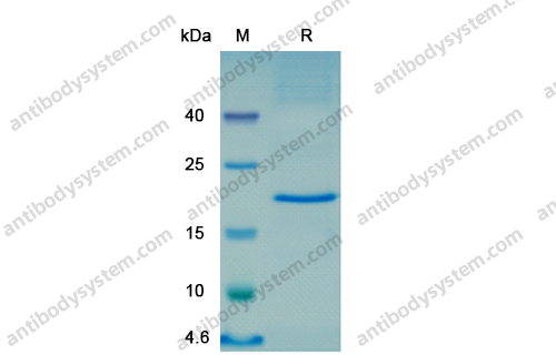 Recombinant SARS-CoV-2 S2 Protein, N-His