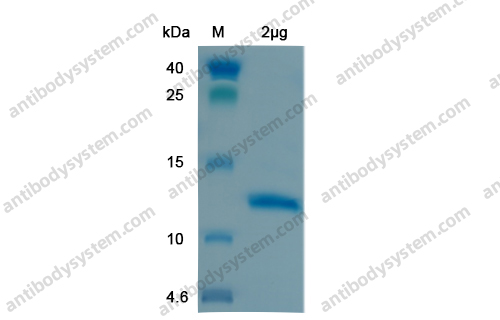 Recombinant SARS-CoV-2 S2 Protein, N-His