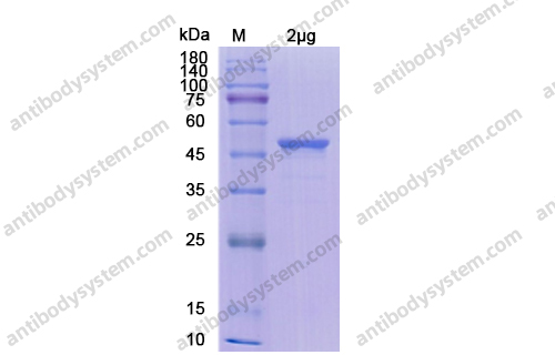 Recombinant SARS-CoV-2 N Protein, N-His