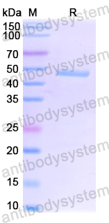 Recombinant SARS-CoV-2 NP/Nucleoprotein (Omicron) Protein, N-His