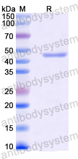 Recombinant SARS-CoV-2 NP/Nucleoprotein Protein, C-His