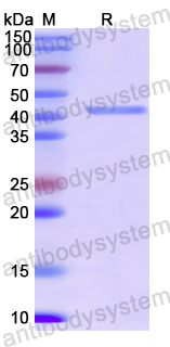 Recombinant SARS-CoV-2 S Protein & E Protein & M Protein, C-His