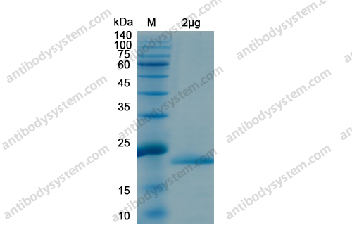 Recombinant SARS-CoV-2 NSP1 Protein, N-His