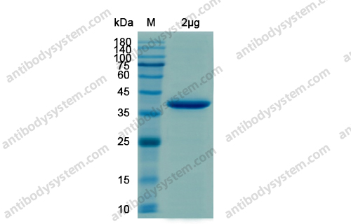 Recombinant SARS-CoV-2 NSP3/PL-PRO Protein, N-His