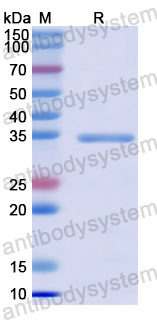 Recombinant SARS-CoV-2 NSP5/3CL-PRO/M Pro Protein, N-His